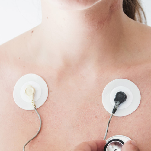 Electrical stimulation with mono and bipolar rectangular currents